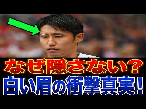 😱 世界中が涙した…伊藤洋輝が“白い眉”を隠さない本当の理由とは? 😱 世界中が涙した…伊藤洋輝が“白い眉”を隠さない本当の理由とは?