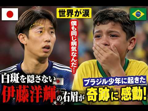 【世界が涙】白斑を隠さない伊藤洋輝…右眉がブラジル少年に起こした奇跡に感動の声続出!love 【世界が涙】白斑を隠さない伊藤洋輝…右眉がブラジル少年に起こした奇跡に感動の声続出!love