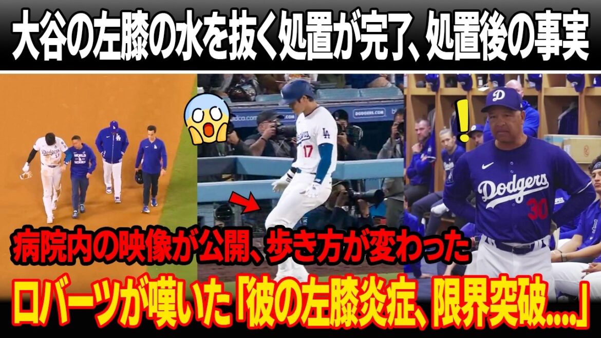 大谷翔平の左膝の水を抜く処置が完了、処置後に判明した事実!病院内の映像が公開、歩き方が変わった…大谷に広がる心配!ロバーツ監督が嘆いた「彼はもう限界に達してる」